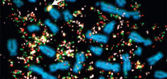 Chromothripsie : à la découverte des tempêtes génétiques