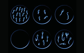 Le spermatozoïde, patient malade de la reproduction ? La chronique d’Anne-Sophie Moreau
